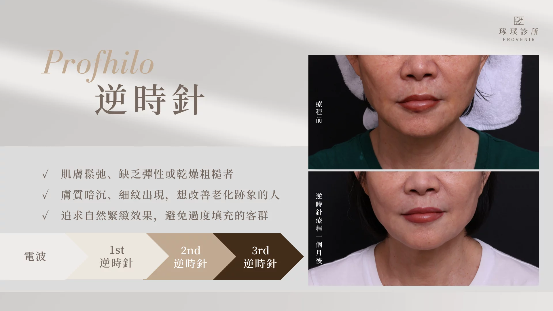 Profhilo逆時針BA_琢璞診所